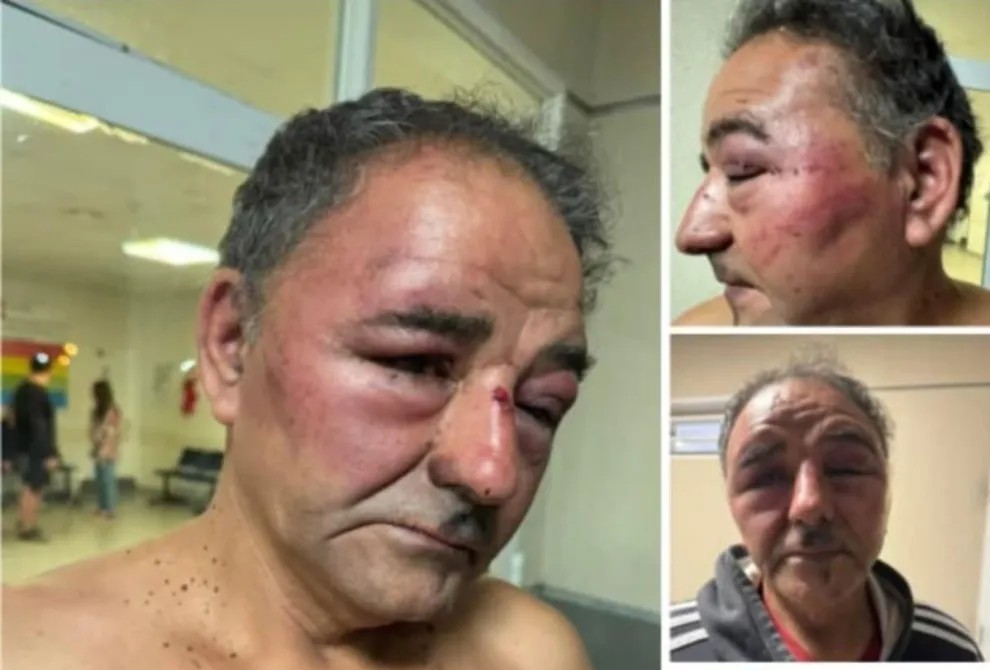 El hombre golpeado por la policía sufrió traumatismo de cráneo y facturas de cost...